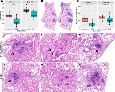 Heterogeneity in immune cell composition is associated with Mycobacterium tuberculosis replication at the granuloma level